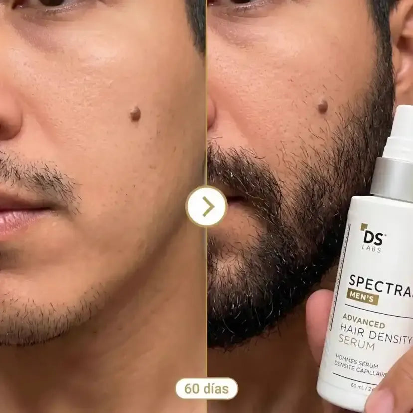 Spectral - Nanoxidil™ - Recupera Cabello y Barba Desde la Raíz - 40% Off