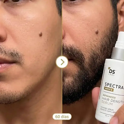 Spectral - Nanoxidil™ - Recupera Cabello y Barba Desde la Raíz - 40% Off